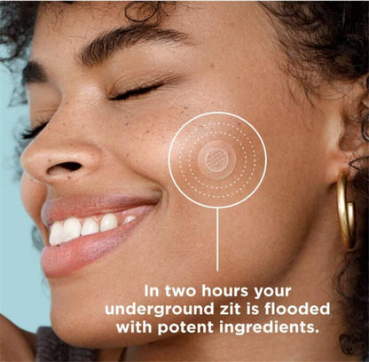 9-Piece Microneedle Acne Patches with Hyaluronic Acid & Salicylic Acid