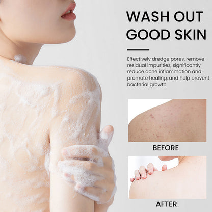 Bamboo Charcoal Back Cleansing Soap with Coconut & Olive Oil