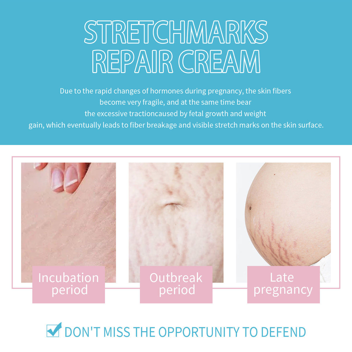 Stretch Mark Care Cream with Collagen, Elastin & Jojoba Oil