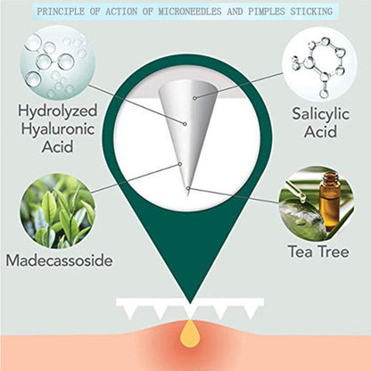 9-Piece Microneedle Acne Patches with Hyaluronic Acid & Salicylic Acid
