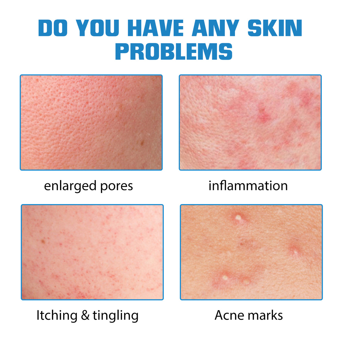 ELHOE Hyaluronic Acid Face Serum Hydrating Facial Serum