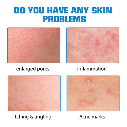 ELHOE Hyaluronic Acid Face Serum Hydrating Facial Serum