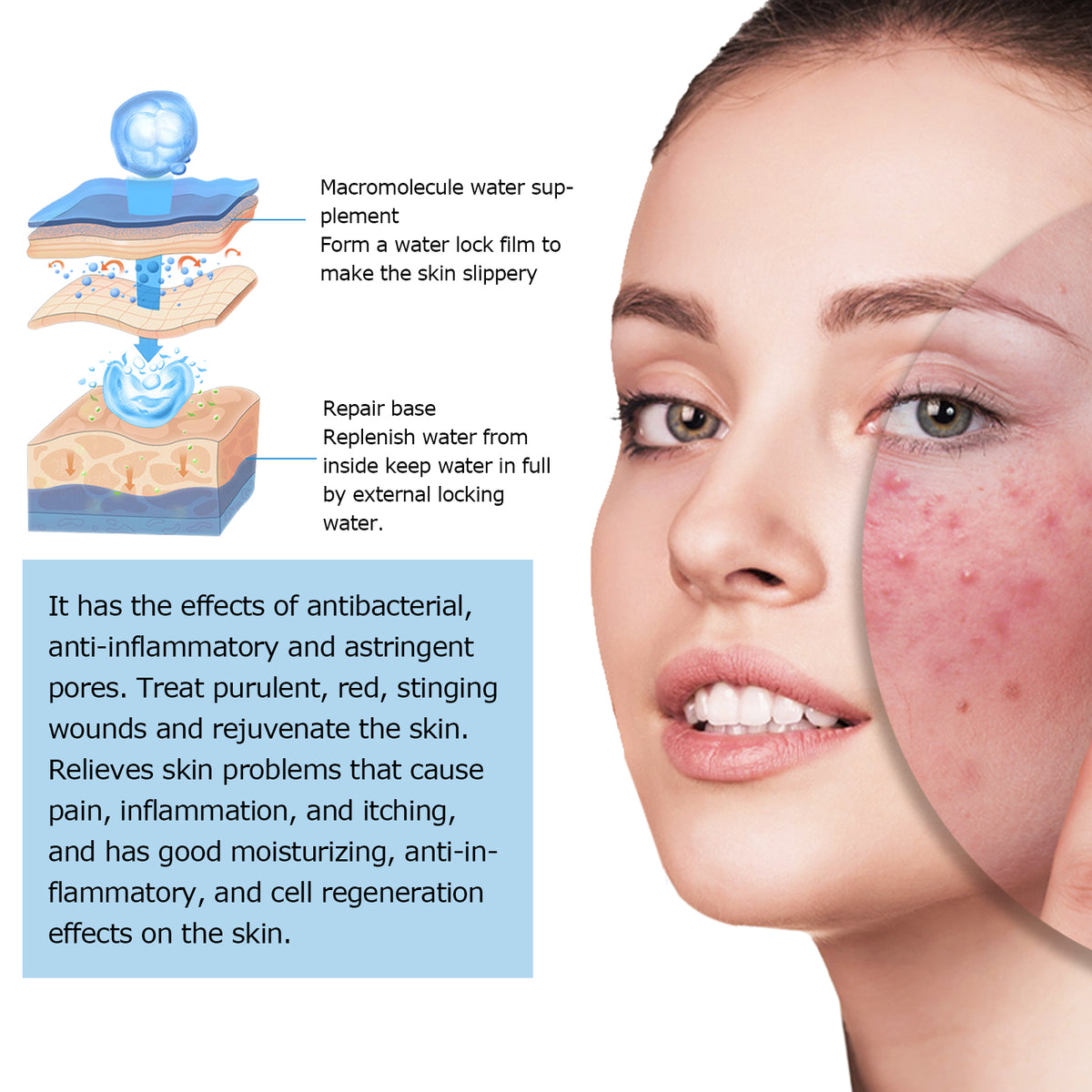 ELHOE Hyaluronic Acid Face Serum Hydrating Facial Serum