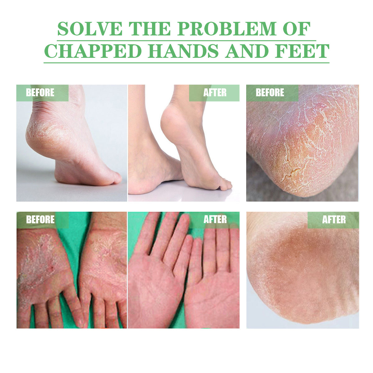 Dry Hand & Foot Repair Cream