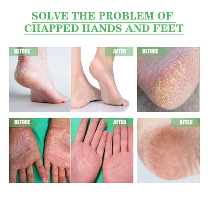 Dry Hand & Foot Repair Cream