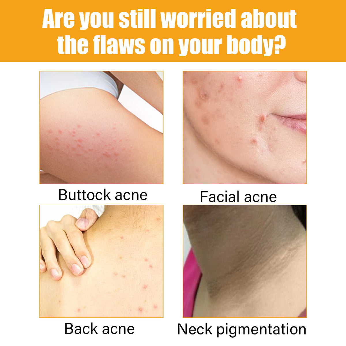 Jayusing Acne Care Body Serum with Collagen Peptides & Jojoba Oil