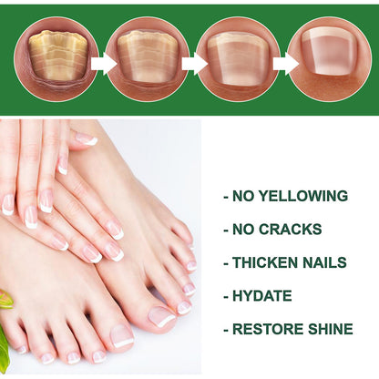 Nail Care Moisturizing Treatment