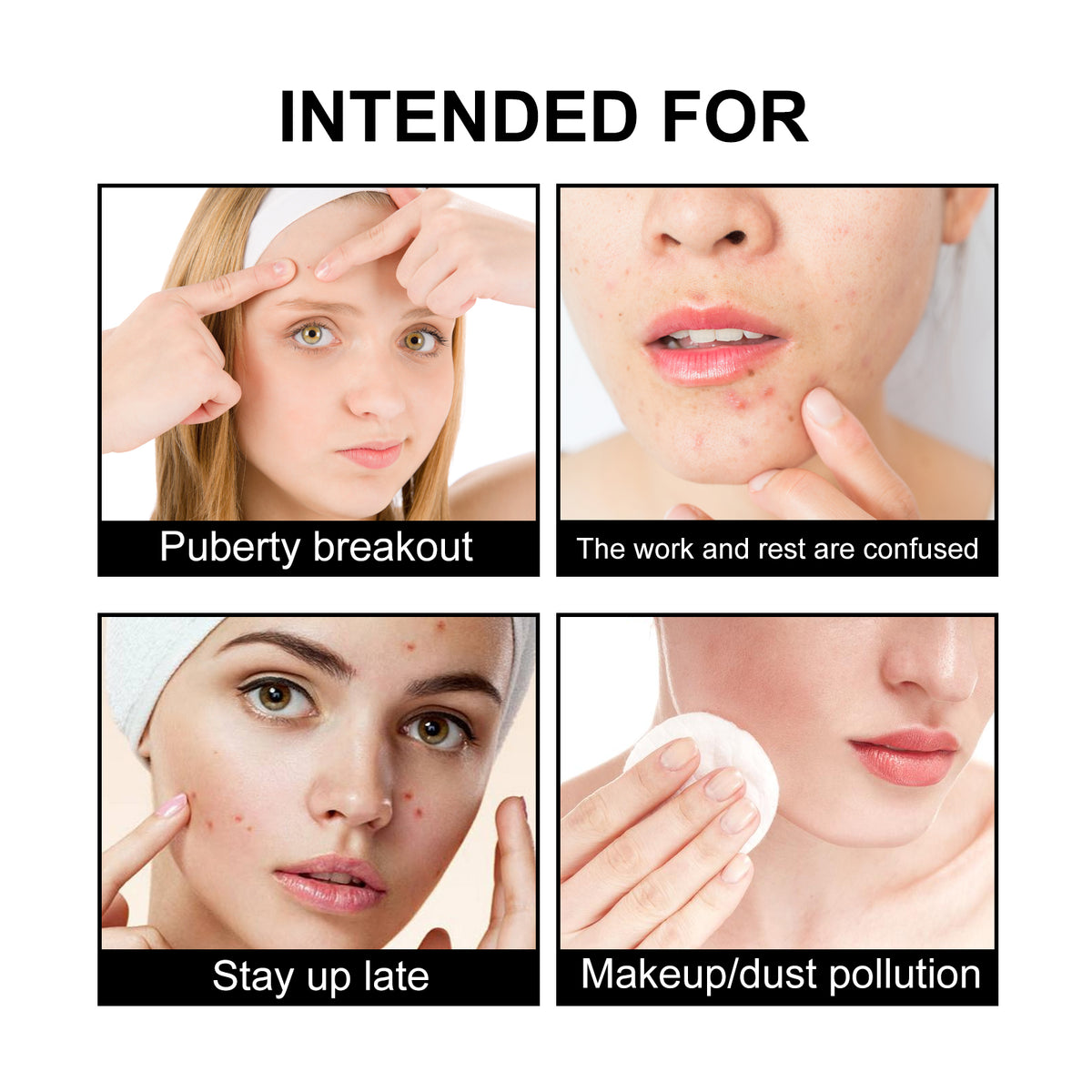 JAYSUING Cute Black Acne Patches – Decorative Blemish Cover Patches