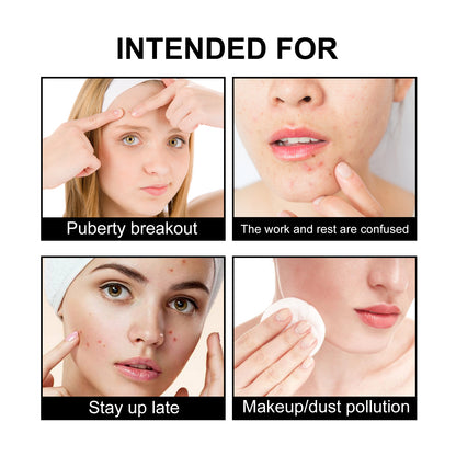 JAYSUING Cute Black Acne Patches – Decorative Blemish Cover Patches