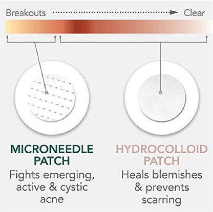 9-Piece Microneedle Acne Patches with Hyaluronic Acid & Salicylic Acid