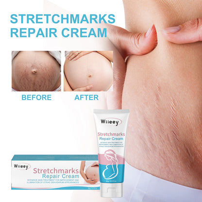 Stretch Mark Care Cream with Collagen, Elastin & Jojoba Oil