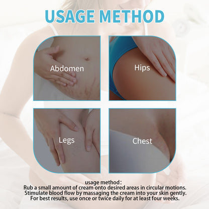 Stretch Mark Care Cream with Collagen, Elastin & Jojoba Oil